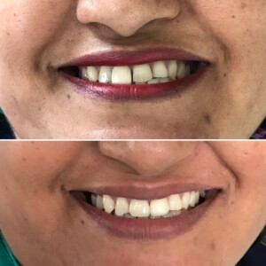 Before & After