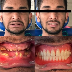 Before & After