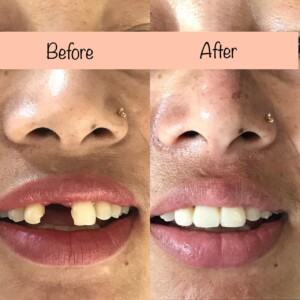 Before & After